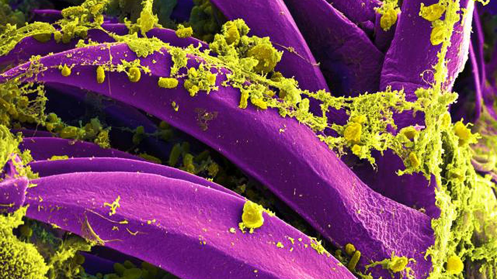 Yellow plague bacteria clustered on curved purple spines inside a flea's gut, in a colourised scanning electron micrograph